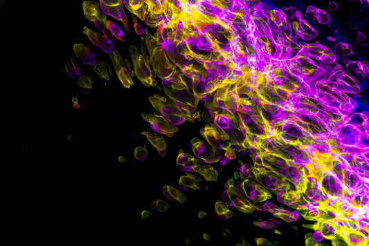 Pink Tourmaline and the Fluorescence Debate: Separating Fact from Fiction in the Treatment Controversy
