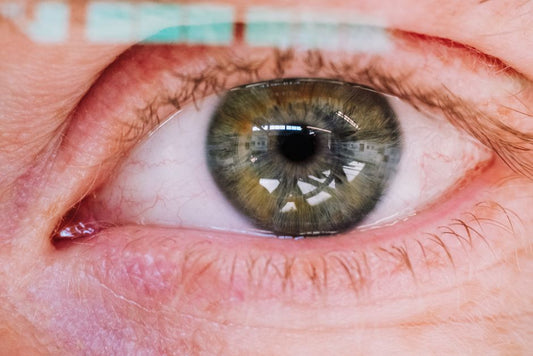 The Black Opal Dilemma: How Treatment Controversy Shapes Perception of Its Optical Phenomena