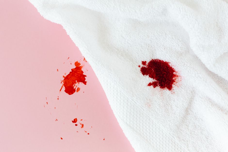How to Spot a Synthetic or Imitation Pigeon Blood Ruby: A Beginner's Guide