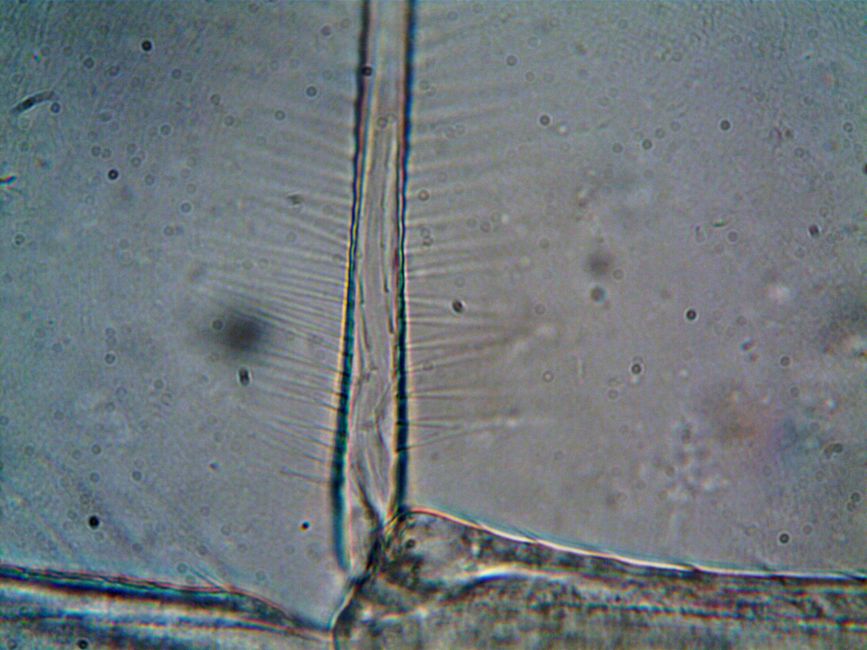 Chrysoberyl Exsolution Lamellae and the Limits of Microscopic Diagnosis