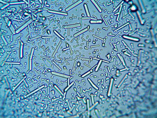 The Star Ruby: A Case Study in Asterism and Trace Element Chemistry